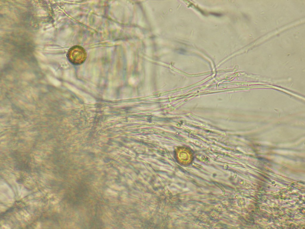 ベッコウタケの菌糸と厚壁胞子