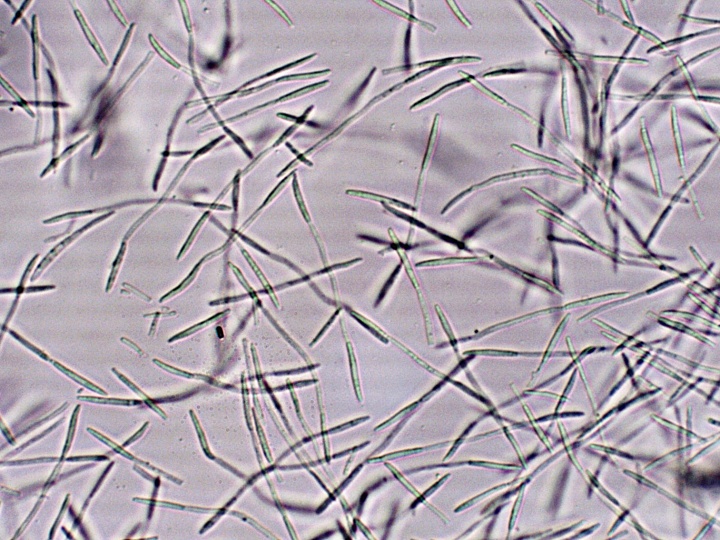 ナンテン紅斑病